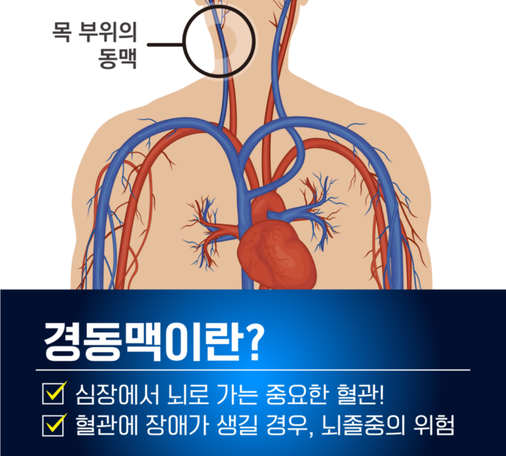 40대 50대 건강 검진 항목 추천 : 경동맥 초음파